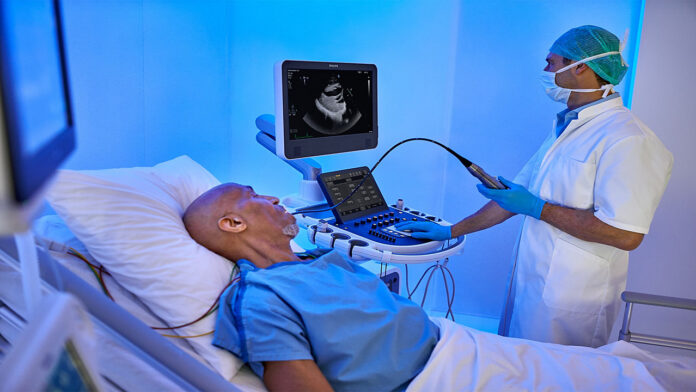 Philips ultrasound cardiac systems EPIQ CVx, Affiniti CVx, and Compact 5500 CV AI-powered platforms with new enhanced image quality.